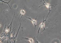 invertirovannyy-biologicheskiy-mikroskop-mib-22.jpg invertirovannyy-biologicheskiy-mikroskop-mib-22.jpg